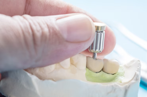 dental implants in wight county va