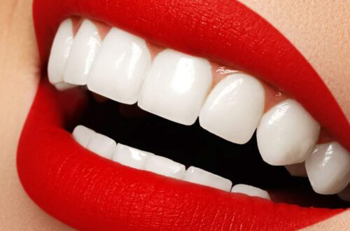 Best Teeth Cleaning Medical Center in Dubai