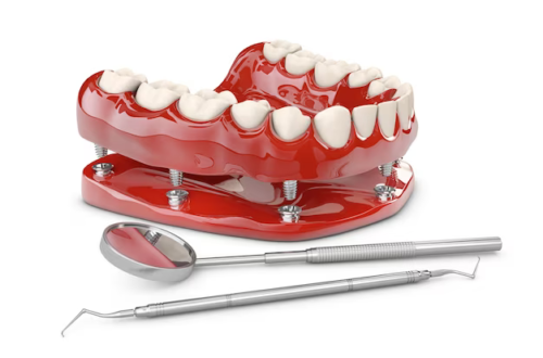 dental implants gulfport ms