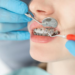 orthodontic correction rayne la